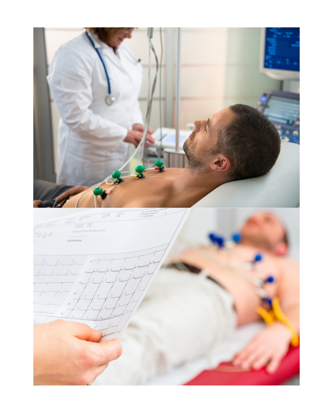 EKG