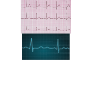 Ekg Technician Workshop