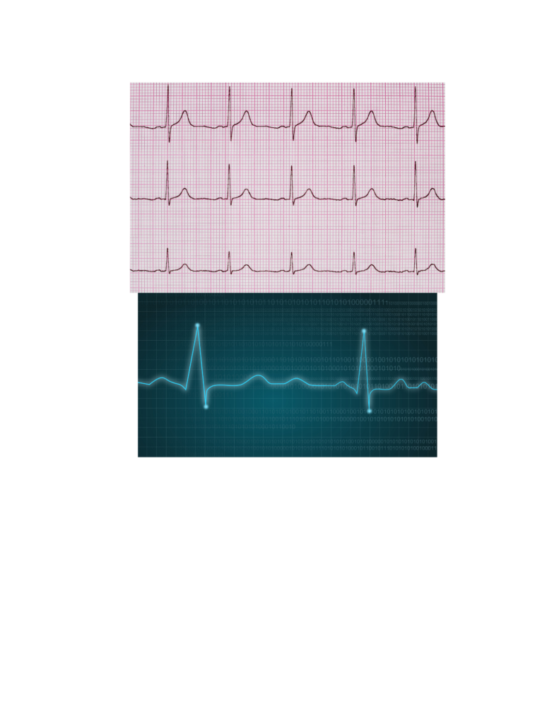 Ekg Technician Workshop